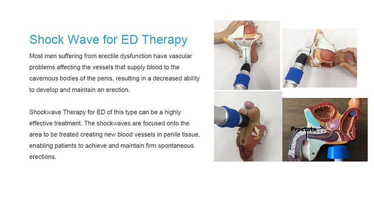 shockwave therapy portable ed machine